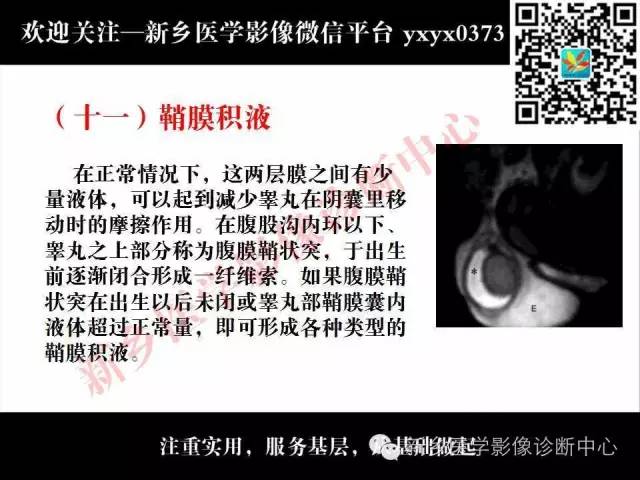 【PPT】阴囊病变影像诊断