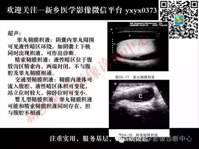【PPT】阴囊病变影像诊断