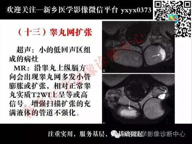 【PPT】阴囊病变影像诊断