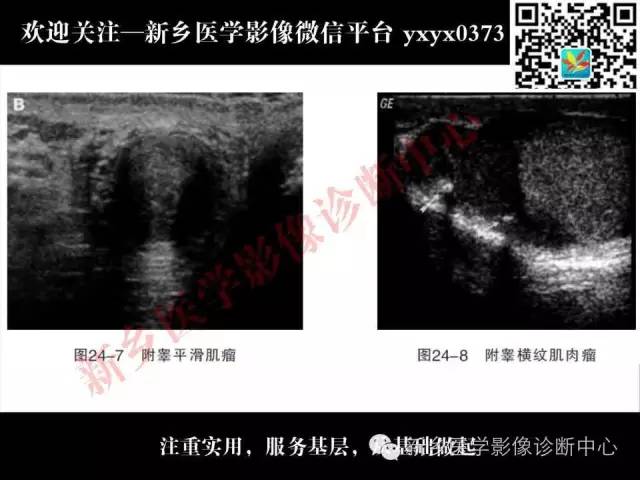 【PPT】阴囊病变影像诊断