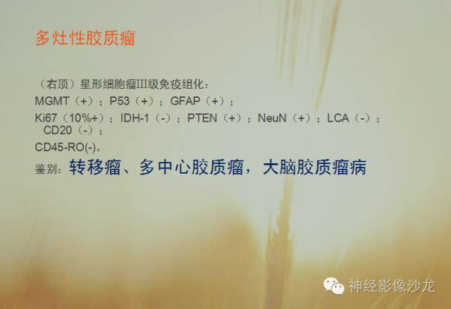 【病例】多灶性胶质瘤1例CT及MR影像表现