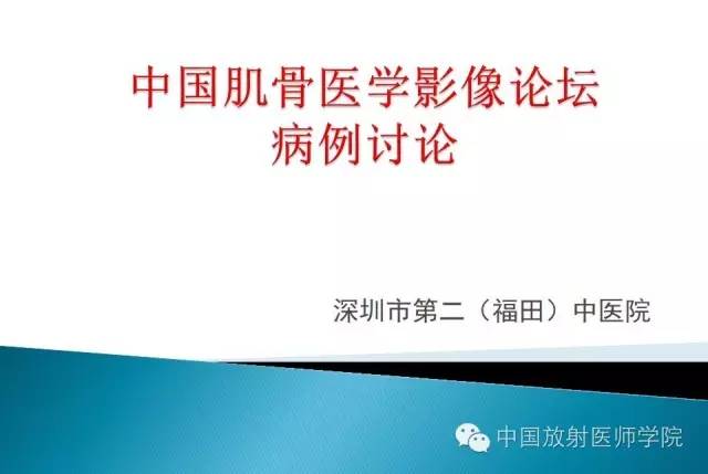 【病例】晚发型脊柱骨骺发育不良1例X线影像表现