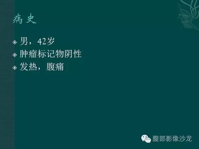 【病例】小肠胃肠道间质瘤1例CT影像表现