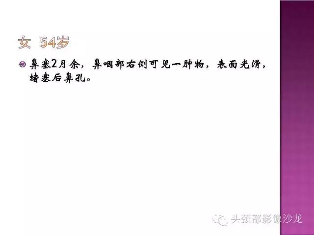 【病例】鼻咽部淋巴瘤1例MR影像表现