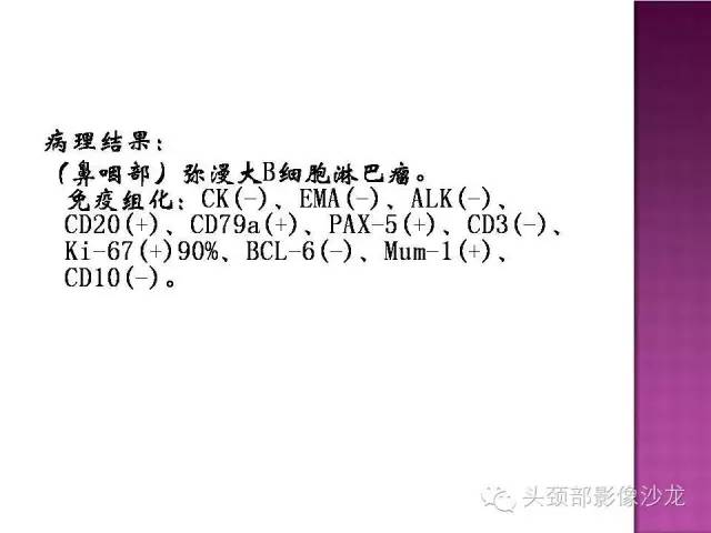 【病例】鼻咽部淋巴瘤1例MR影像表现 【病例】鼻咽部淋巴瘤1例MR影像表现