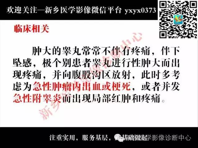 【PPT】睾丸肿瘤影像诊断