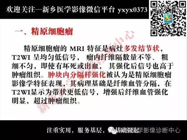 【PPT】睾丸肿瘤影像诊断
