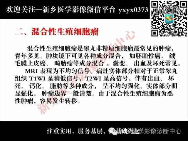 【PPT】睾丸肿瘤影像诊断