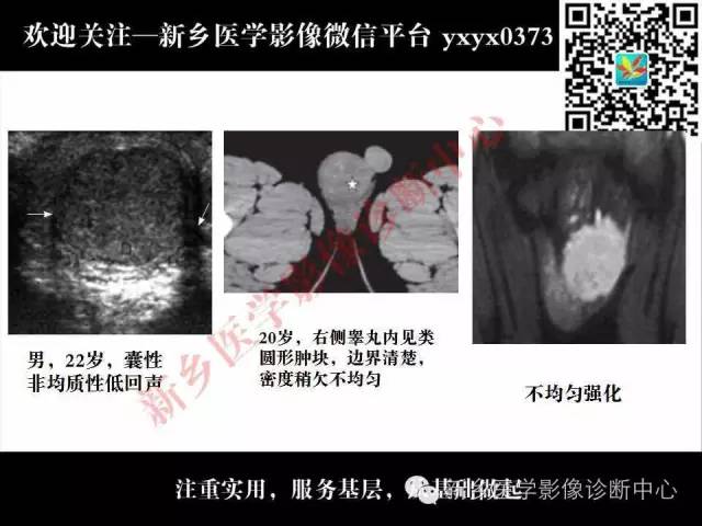 【PPT】睾丸肿瘤影像诊断