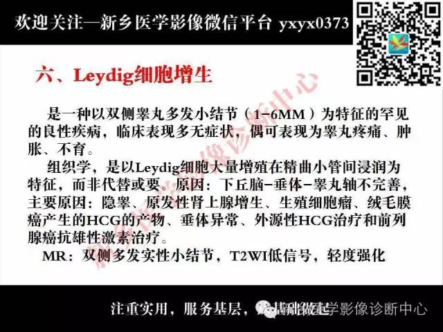 【PPT】睾丸肿瘤影像诊断