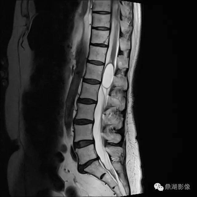 原来认识的第五脑室竟然是“错误”的？