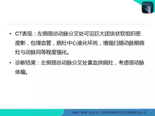 【病例】颈动脉体瘤1例影像诊断