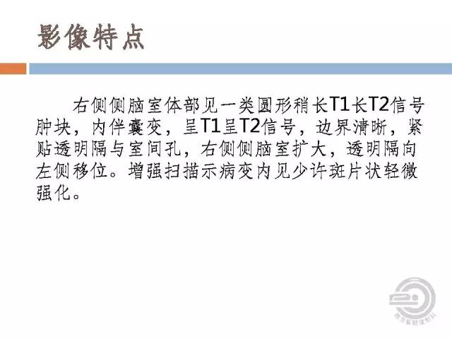 【病例】右侧脑室星形细胞瘤WHOII级一例MR影像表现