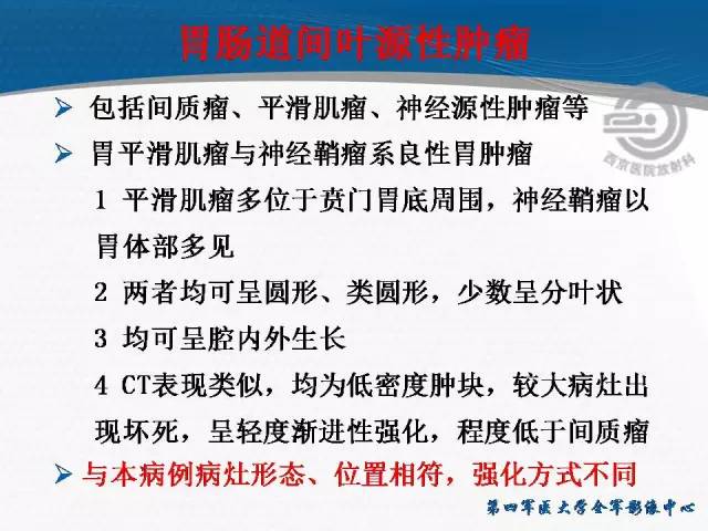 【病例】胃体神经内分泌肿瘤1例CT影像表现