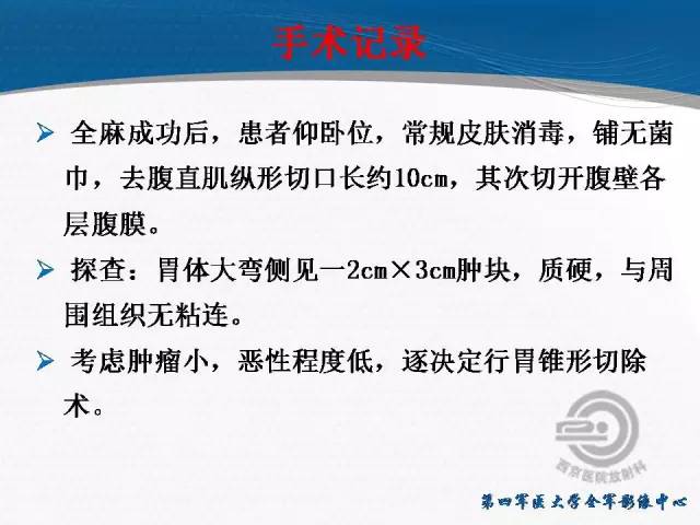 【病例】胃体神经内分泌肿瘤1例CT影像表现