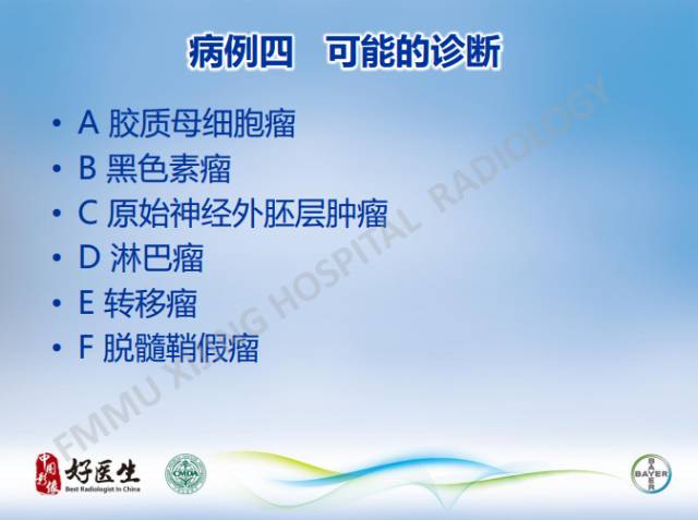 【病例】原发性中枢神经系统淋巴瘤1例MR影像表现