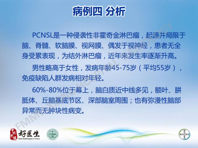 【病例】原发性中枢神经系统淋巴瘤1例MR影像表现