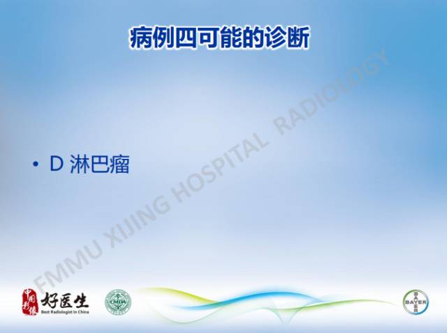 【病例】原发性中枢神经系统淋巴瘤1例MR影像表现