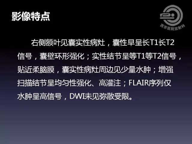 【病例】右额叶多形性黄色星形细胞瘤1例MR影像表现