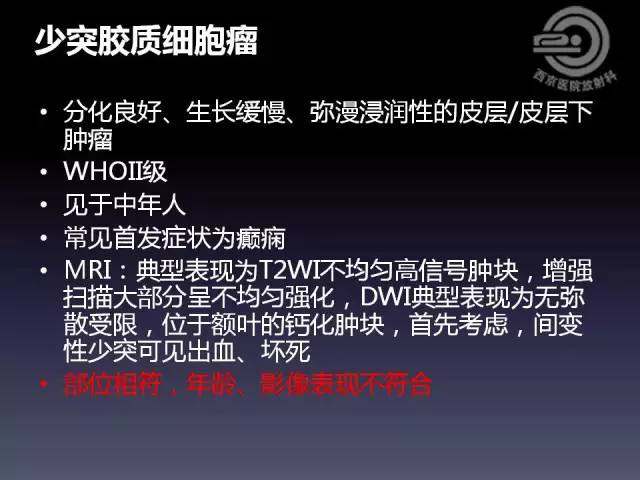 【病例】右额叶多形性黄色星形细胞瘤1例MR影像表现