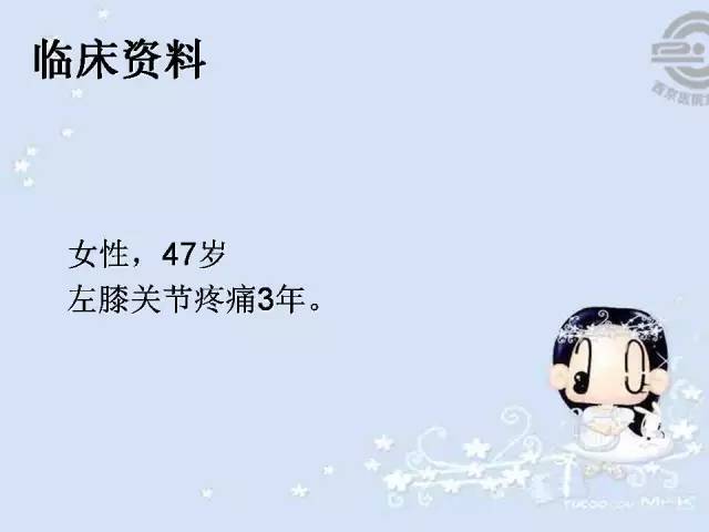 【病例】胫骨软骨粘液样纤维瘤1例影像表现