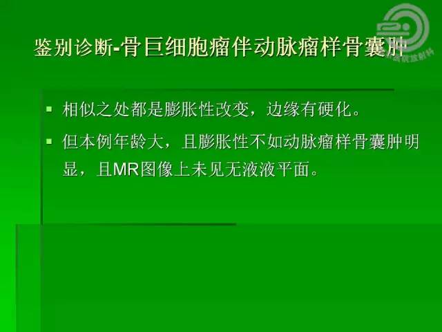 【病例】胫骨软骨粘液样纤维瘤1例影像表现