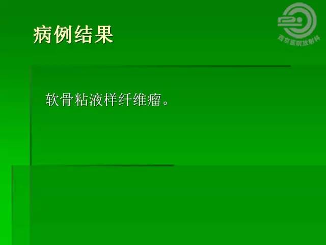 【病例】胫骨软骨粘液样纤维瘤1例影像表现