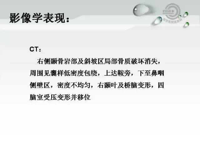 【病例】颅底软骨肉瘤1例CT及MR影像表现