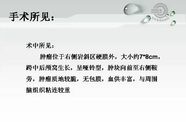 【病例】颅底软骨肉瘤1例CT及MR影像表现
