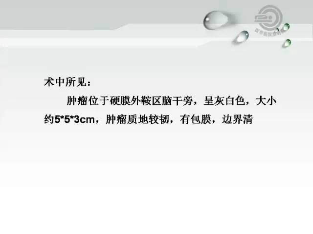 【病例】颅底软骨肉瘤1例CT及MR影像表现