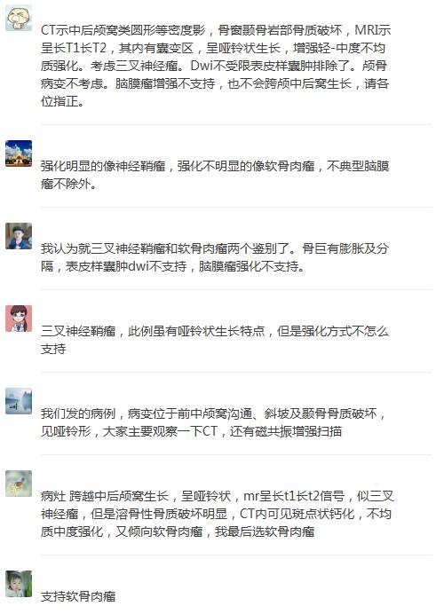 【病例】颅底软骨肉瘤1例CT及MR影像表现