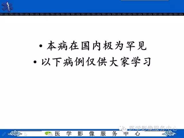 【影像征象】鱼口征——镰状细胞病
