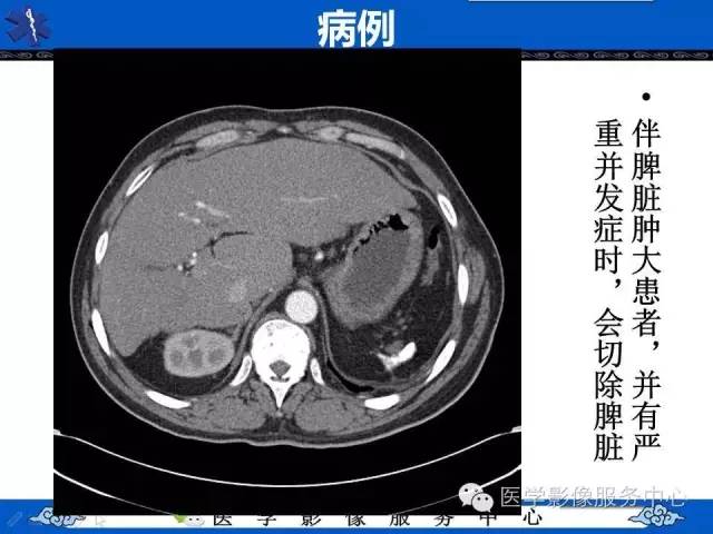 【影像征象】鱼口征——镰状细胞病