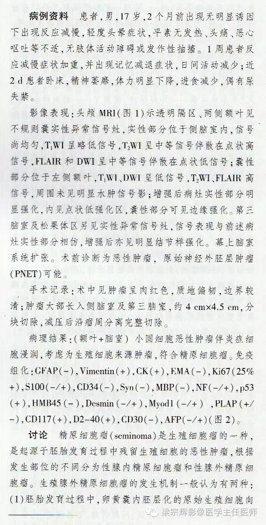 【病例】脑室内外占位性病变——精原细胞瘤1例