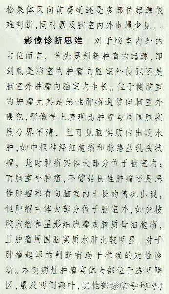 【病例】脑室内外占位性病变——精原细胞瘤1例
