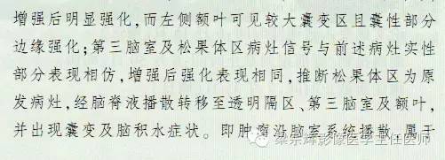 【病例】脑室内外占位性病变——精原细胞瘤1例