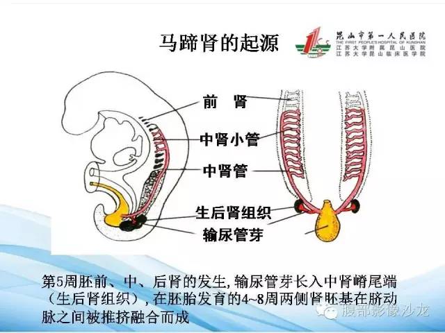 【PPT】64层螺旋CT血管成像对马蹄肾供血动脉的解剖学观察 【PPT】64层螺旋CT血管成像对马蹄肾供血动脉的解剖学观察