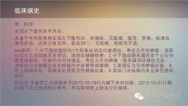 【病例】腹膜后未分化多形性肉瘤1例CT影像表现