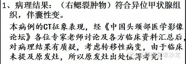 【病例】右颈部异位甲状腺1例CT影像表现