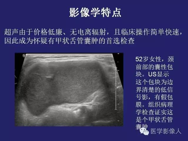 【PPT】异位甲状腺和甲状舌管囊肿影像学表现