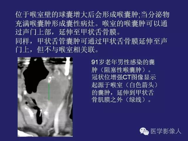 【PPT】异位甲状腺和甲状舌管囊肿影像学表现