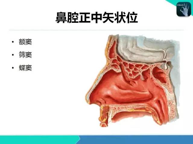 【PPT】鼻和鼻窦疾病影像学诊断