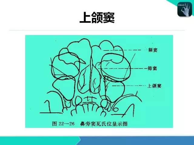 【PPT】鼻和鼻窦疾病影像学诊断