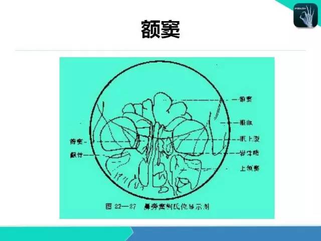 【PPT】鼻和鼻窦疾病影像学诊断