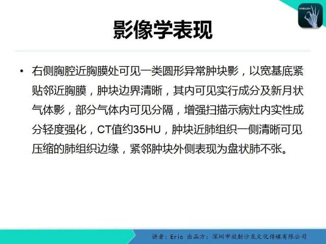 【病例】胸膜局限性纤维性肿瘤1例CT影像表现