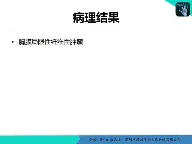 【病例】胸膜局限性纤维性肿瘤1例CT影像表现