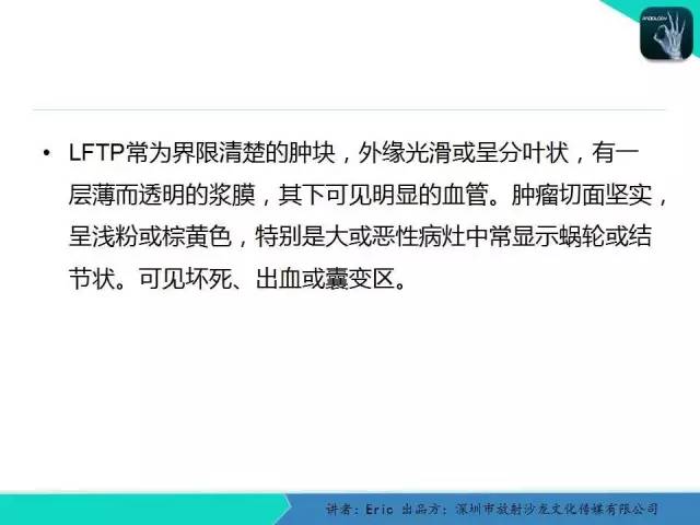 【病例】胸膜局限性纤维性肿瘤1例CT影像表现