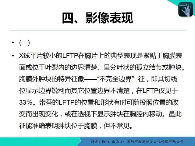 【病例】胸膜局限性纤维性肿瘤1例CT影像表现
