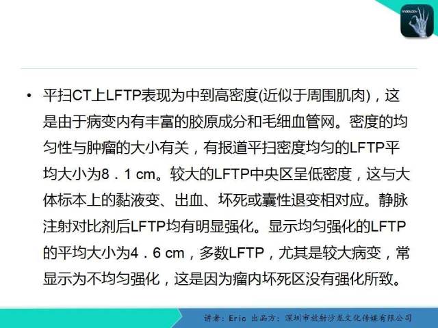 【病例】胸膜局限性纤维性肿瘤1例CT影像表现