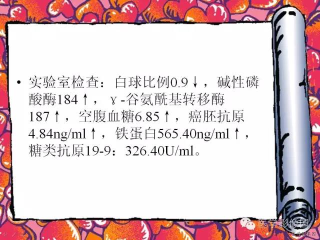 【病例】纤维肉芽肿型肝脓肿1例CT影像表现 【病例】纤维肉芽肿型肝脓肿1例CT影像表现